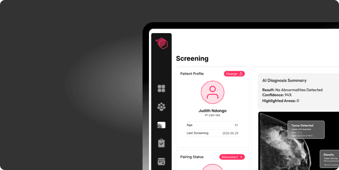 IntelliBra AI screening dashboard showing a patient diagnosis summary